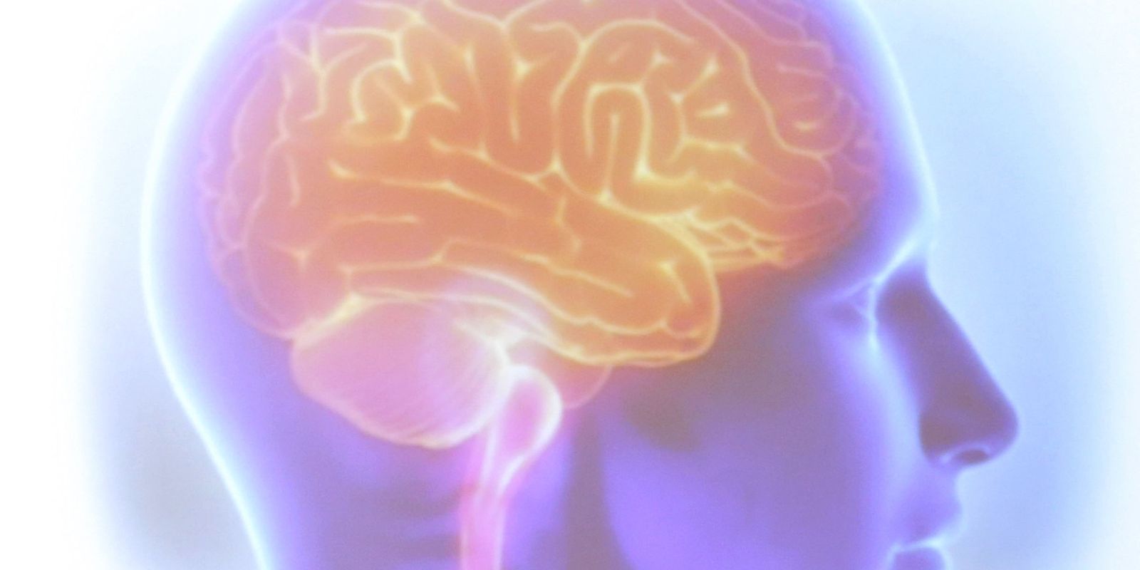 AVC mata uma pessoa a cada seis minutos no Brasil