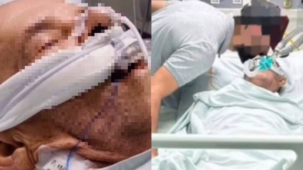 Idoso de 68 anos está em estado gravíssimo após agressão do sobrinho em Barra Velha