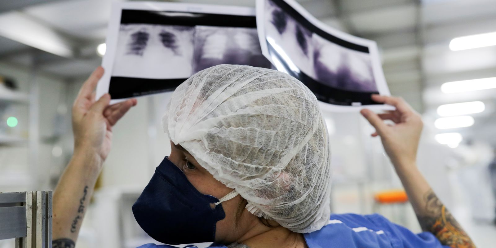Brasil deve ter 781 mil novos casos de câncer por ano até 2028