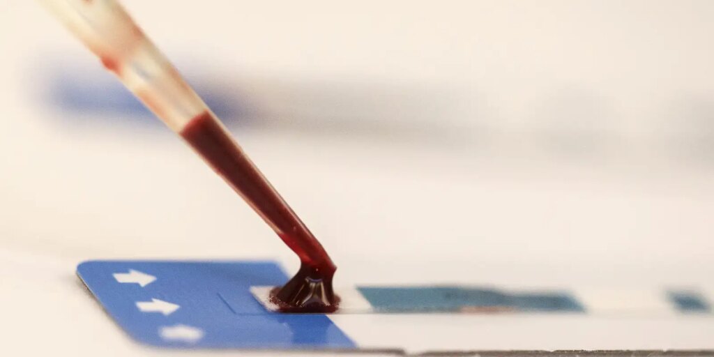 Pesquisa da Fiocruz traz nova esperança na prevenção do HIV entre jovens brasileiros