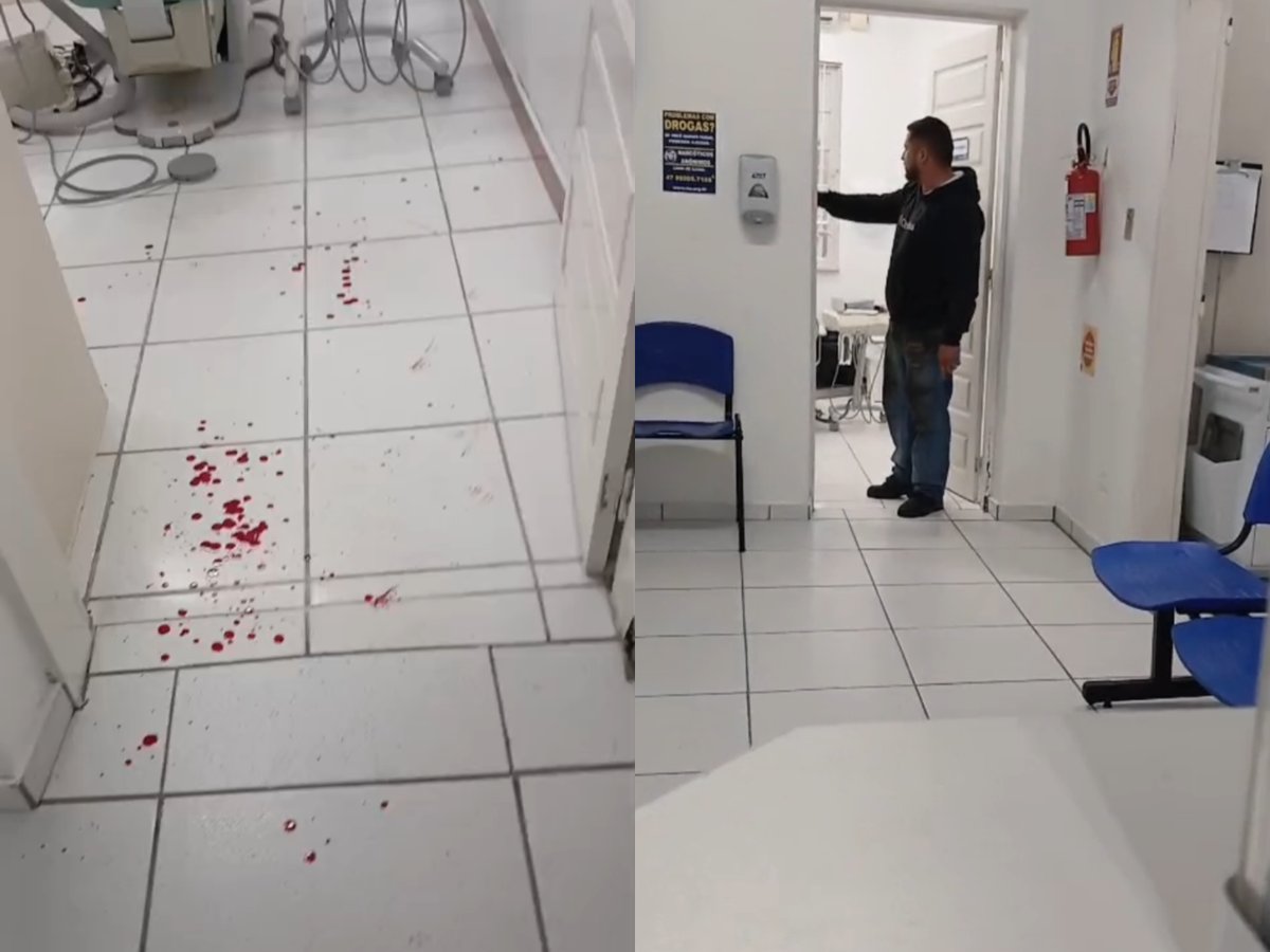 Criança de 10 anos sai sangrando de consulta e pai parte para cima de dentista em Blumenau