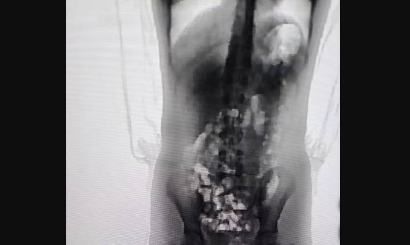 Adolescente de 13 anos é flagrada com “supermaconha” dentro do corpo em presídio de SC