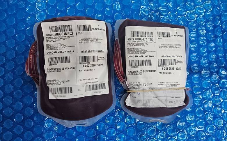 Bolsas de sangue raro chegam a SC para atender criança com anemia falciforme